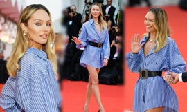 Mặc váy như pyjama của chồng, siêu mẫu Nam Phi khoe chân dài mê mải