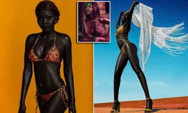 ‘Nữ hoàng bóng đêm’ nổi tiếng vì làn da quá đen