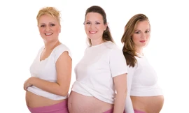 Ốm nghén là dấu hiệu của một thai kỳ khỏe mạnh