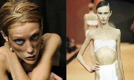 Phụ nữ quá gầy có nguy cơ mắc nhiều bệnh nghiêm trọng