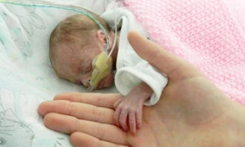 Sức sống kỳ diệu của em bé chào đời chỉ nặng 700 gam