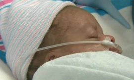 Kỳ diệu: Em bé chào đời khi vẫn còn trong túi ối