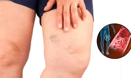 Ảnh minh họa: Authority Remedies 