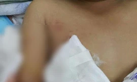 Bé trai bị cắt lìa tay khi nhặt dép trên băng chuyền