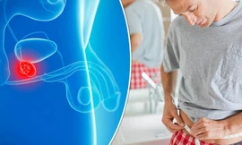 Làm thế nào phát hiện sớm ung thư tuyến tiền liệt?