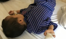 Các bác sĩ cho biết tai nạn ở trẻ em để lại nhiều hậu quả nặng nề cả về thể chất và tinh thần. Những thương tổn khiến các em mất đi cơ hội trong học tập cũng như cuộc sống. Bé trai đang được điều trị tại bệnh viện. Ảnh: Bệnh viện cung cấp. 