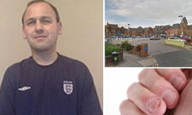 Đột tử vì thói quen cắn móng tay