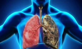 Ảnh minh họa: Internet