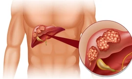 Ảnh minh họa tử Internet