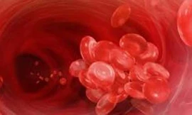 6 dấu hiệu cảnh báo cục máu đông nguy hiểm