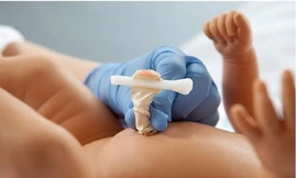 Bé sơ sinh tử vong vì uốn ván do cắt dây rốn bằng cật nứa