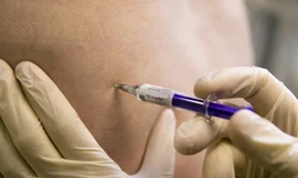 Ảnh minh họa: NHS Choices 