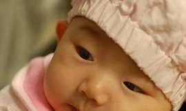 Xử trí khi bé hay nôn trớ