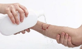 Cách phòng tránh và xử lý khi bị chó mèo cắn