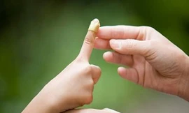 Cách sơ cứu đúng với những tai nạn trẻ thường gặp