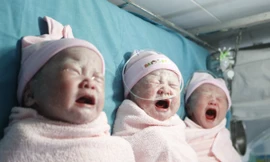 Sản phụ sinh ba bé gái đều cân nặng trên 2,5 kg