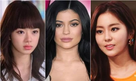 Những ngôi sao hóa ‘thiên nga’ nhờ phẫu thuật thẩm mỹ