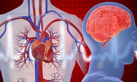 Ảnh minh họa: New Health Advisor 