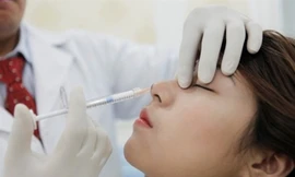 Bị thối thịt sau 2 ngày cấy chỉ nâng mũi