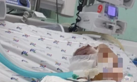 Vụ bé 6 tháng tuổi bị đánh dập não: Nạn nhân thương tích 99%