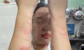 Điều tra vụ việc thiếu nữ 17 tuổi bị mẹ ruột đánh gây thương tích ở TP Thủ Đức 
