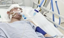 Tình hình sức khỏe nam sinh lớp 8 bị đánh chấn thương sọ não