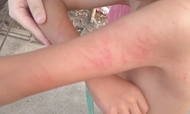 Bản tin 8H: Phụ huynh tát cô giáo ngay tại sân trường