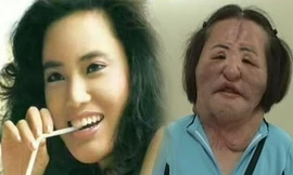 'Ca sĩ nghiện dao kéo' xứ Hàn chết trong cô độc ở tuổi 57