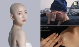 Ngưỡng mộ tinh thần 'chiến đấu' với ung thư của hot girl Hàn Quốc 