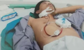 Anh Mai Thế Duy (con bà Lý) bị vỡ xương hàm mặt cầu lồi bên phải, tỉ lệ thương tật 15%. (Ảnh: NVCC/VTC New) 