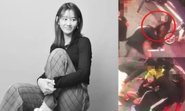 Người mẫu khiếm thính Hàn bị đánh đến chấn động não vì vô tình va phải người phụ nữ 