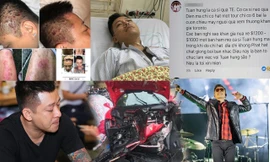 Loạt 'tai nạn' khiến Tuấn Hưng thành sao Việt gặp 'vận đen' nhất 2018