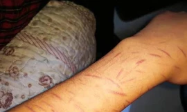 Mẹ là giáo viên giỏi sao không ngăn được con gái quan hệ tình dục với nam sinh