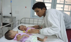 12 giờ 'cân não' tách rời cặp song sinh dính nhau phần xương cụt