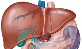Các yếu tố làm tăng nguy cơ mắc ung thư gan