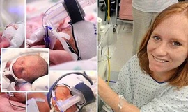 Sinh 5 con trong 5 phút