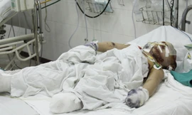 Honda hỗ trợ gia đình nạn nhân vụ nổ xe máy