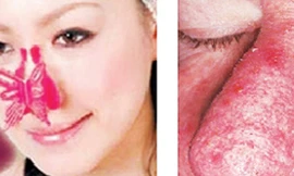 Bôi kem nở mông, to ngực coi chừng rước họa