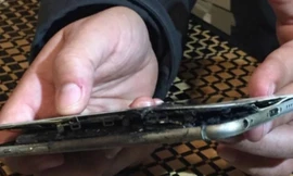 Hãi hùng iPhone 6 Plus bất ngờ bốc cháy trong túi quần