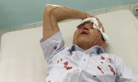 Anh Kiệt bị đa chấn thương