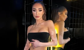 Người mẫu bạch biến gây chú ý ở Hoa hậu Hòa bình 2024