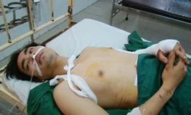 Bị đánh một cảnh sát bắn dân