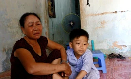 Bà Nam bức xúc vì cháu mình bị cô giáo đánh tím đùi