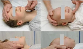 Phản ứng nhanh khi trẻ bị dị vật đường thở