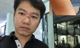 Người dân 'tố' bị người lạ hành hung khi làm việc với CSGT Hàng Xanh 