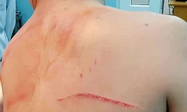 Vợ bác sĩ thẩm mỹ bị bắt vì nghi thuê người chém chồng