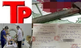 Bản tin Hình sự: Nhân viên quay vịt lẻn vào phòng cô chủ lúc rạng sáng