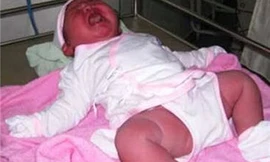 Sản phụ sinh em bé nặng 6kg ở Bình Thuận