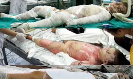 Ông nội thiêu sống cả nhà vì tội 'không biết đẻ'