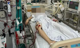 Thông tin mới vụ hai dì cháu bị ngộ độc methanol ở Cà Mau